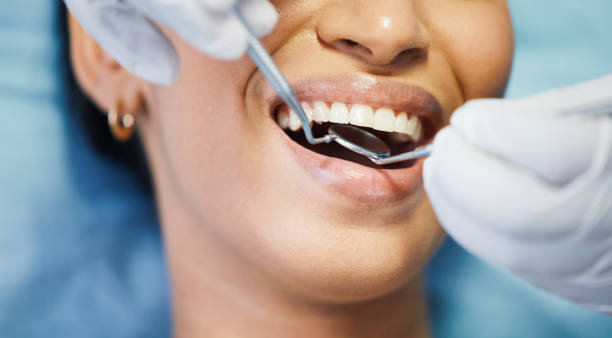Best Emergency Gum Treatment in Woodacre, CA